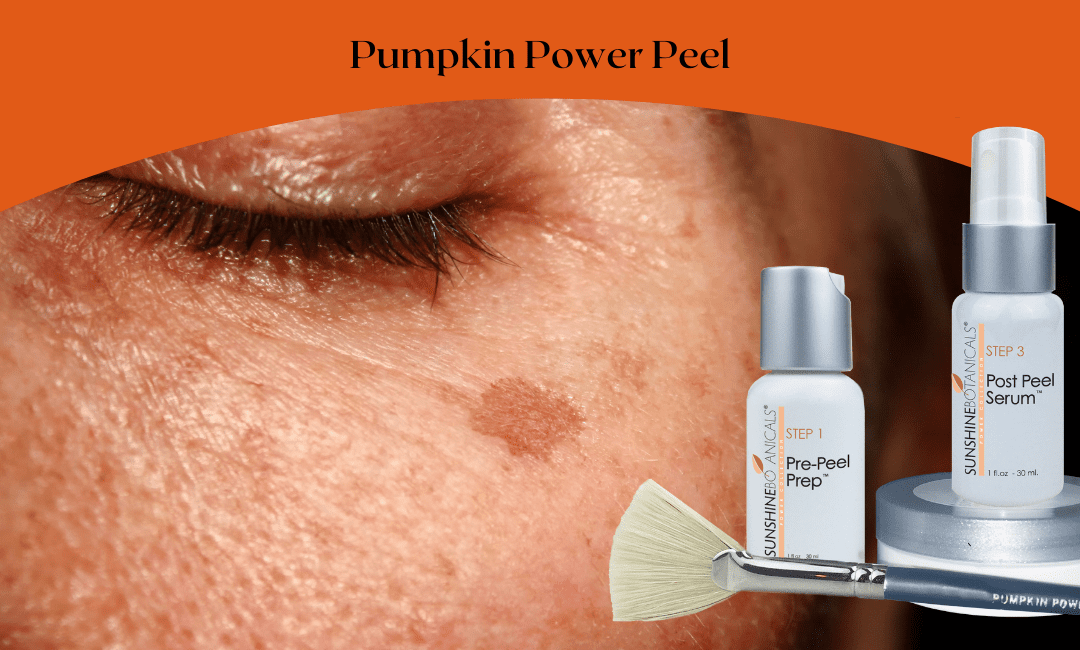 Reward Your Skin with This Amazing Pumpkin Peel System!
