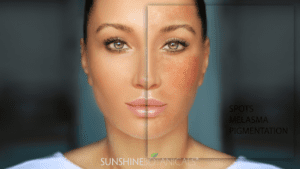 (What you MUST Know About Photoaging) 