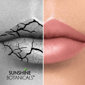 Crack lips - use rapid repair balm from sunshine botanicals