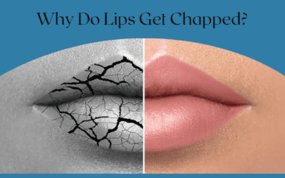 Why Do Lips Get Chapped?