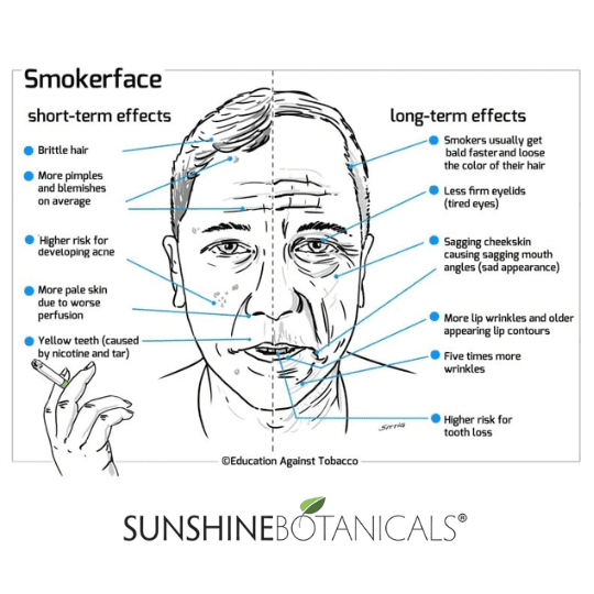 Stop smoking:<br />
Tobacco smoke contains deadly carcinogens that lead to a "smoker's face." Signs of a smoker's face include dull and dry complexion, grayish tint, premature lines and wrinkles, and leathery skin.